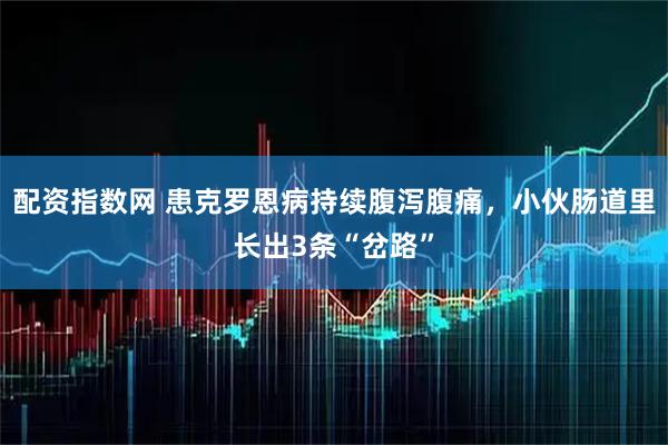 配资指数网 患克罗恩病持续腹泻腹痛，小伙肠道里长出3条“岔路”